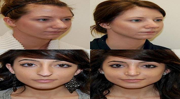 94847d77d29f1a1ac3a79c636b557928.jpg